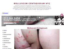 Tablet Screenshot of molluscumcontagiosumnyc.net